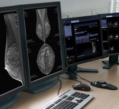 Siemens Healthineers Syngo.Breast Care Adding AI-Based Decision Support