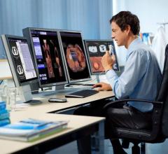 Siemens Healthineers Announces FDA Clearance of syngo.via VB30 Molecular Imaging Software