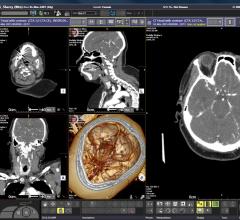 Illuminate and Medexprim Partner to Enhance PACS Data Mining