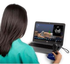 GE Healthcare Expands Collaboration With SonoSim for Ultrasound Education