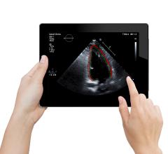 TomTec Unveils TomTec Zero Cardiovascular Viewing Software