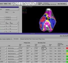 Pinnacle3 Auto-planning: Accelerated IMRT and VMAT Planning With Consistent Results