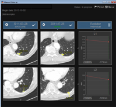 Telemis-Medical PACS, PACS, Telemis