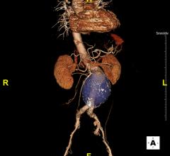 TeraRecon Enhances Speed, Clinical Capabilities With Latest iNtuition Release