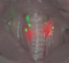 NIR, contrast agents, thyroid, parathyroids, surgery, Frangioni, FLARE