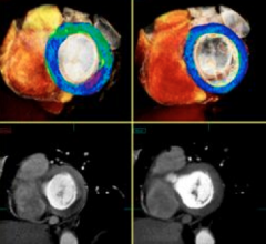 SCCT Covers Latest Trends in Cardiac CT