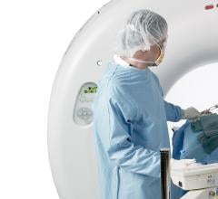 Toshiba Medical Demonstrates Radiation Therapy Planning Enhancements for Aquilion LB CT at ASTRO