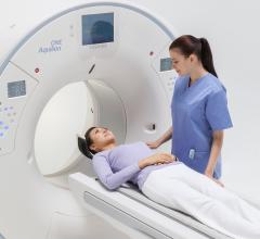 Canon Medical Systems Highlights Aquilion One/Genesis CT Stroke Suite at SIR 2018