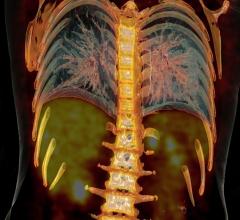 NOPR, CMS, PET, NaF-18, comment period, bone metastasis 