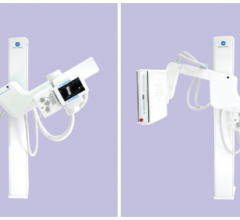 Now available on the KDR Advanced U-Arm, DDR allows clinicians to see how anatomic structures move in relation to one another over a period of time. 