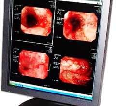 rsna 2013 flat panel displays USEI 