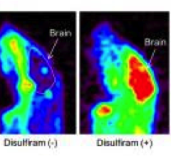 PET imaging in Menkes disease model mice