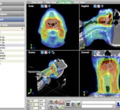 OIS Covers Entire Treatment Process