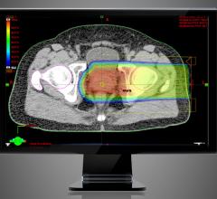 Varian Outlines Strategy for AI-Driven Multimodality Adaptive Radiotherapy Suite