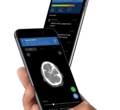 FDA Clears First AI-Powered Clinical Decision Support Software for Stroke