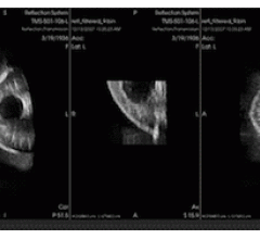 Algorithms Optimize Breast US Images