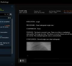 rsna 2013 radiology information system RIS pacs accessories 3m chartscriptmd