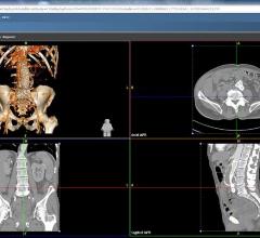 Agfa, Xero Viewer, Full Fidelity, FDA clearance