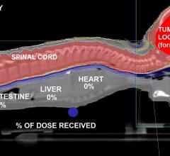 Proton Therapy Center, PTC, health insurance, Czech Republic