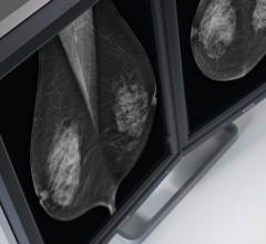 Barco tomosynthesis 5mp mammography systems flat panel displays