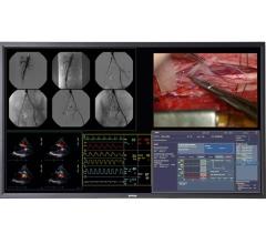 Barco Flat Panel Display MDSC-8258  Hybrid OR RSNA 2014