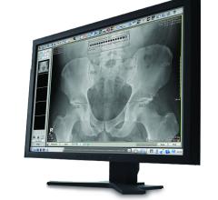 pacs digital radiography dr systems orthopedic imaging rsna 2013 carestream