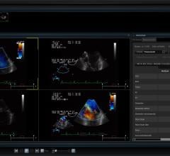 cancer survivors, cardiovascular ultrasound, echocardiograms