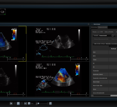 pacs remote viewing systems rsna 2013 cerner skyvue