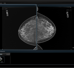 mammography reporting software breast imaging workstations cerner radnet RSNA