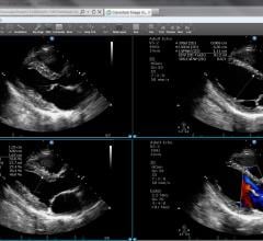 Lexmark Healthcare, Kofax, Enterprise Content Management, ECM, HIMSS 2017, RSNA 2017, SIIM