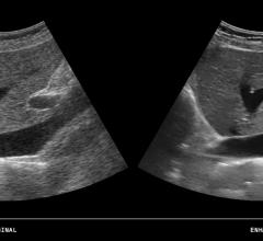 ContextVision, ECR 2016, European Congress of Radiology, advanced visualization