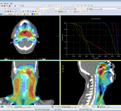 Elekta's Monaco 5 Treatment Planning System to Showcase at AAPM 2014