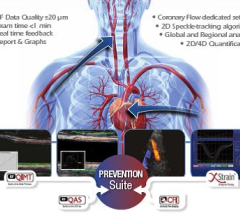 ultrasound systems cardiovascular esaote prevention suite euroecho RF