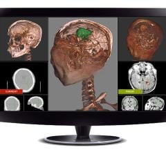 Fovia Medical Inc. Blackford Analysis Ltd. 3-D Registration 