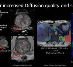 mri systems software rsna 2013 ge DV24.0 Continuum Pak Silent Scan