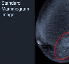 ACR Offers Revised Contrast Media in Imaging Manual