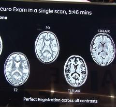 Magic, sigma Pioneer, GE, multiple contrasts in one MRI scan