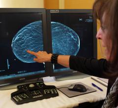 Hologic Receives FDA Approval for Low-Dose 3-D Mammography 