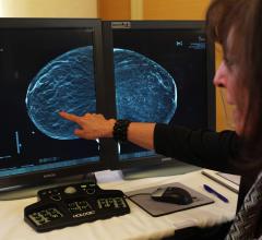 Mammography Market Value in the Americas Projected Beyond $1 Billion by 2020