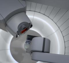 IBA to Install Proton Therapy Facility at Inova Schar Cancer Institute