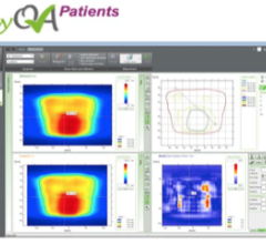 myQA Patients, IBA, quality assurance, radiation therapy, LewisGale Regional