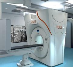 IMRIS siemens CT systems hybrid OR Visius iCT 