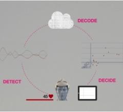 Jan medical, BrainLab, BrainPulse diagnostic tool, concussion, stroke, financing