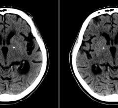 CT systems, Radiation Dose Management, Remanufactured/refurbished equipment RSNA