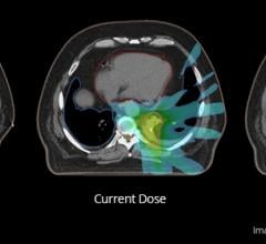 Mirada Medical, deformable image registration, DIR, QA, RegistrationQX, AAPM