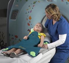 pediatric sports-related head trauma, CT scans, computed tomography, UC Davis, TBIs, traumatic brain injuries