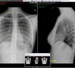 Novarad, NovaPACS, PowerScribe 360 integration, dictation, RSNA 2016