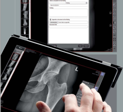 Leonardo DR nano system, X-ray systems, Digital Radiography systems