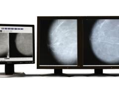 Parascript, AccuDetect CAD for Mammography, computer-aided detection, RSNA 2016