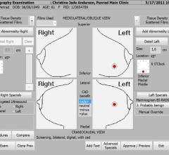 PenRad Mammography Information System 2012 Best in KLAS Awards: 